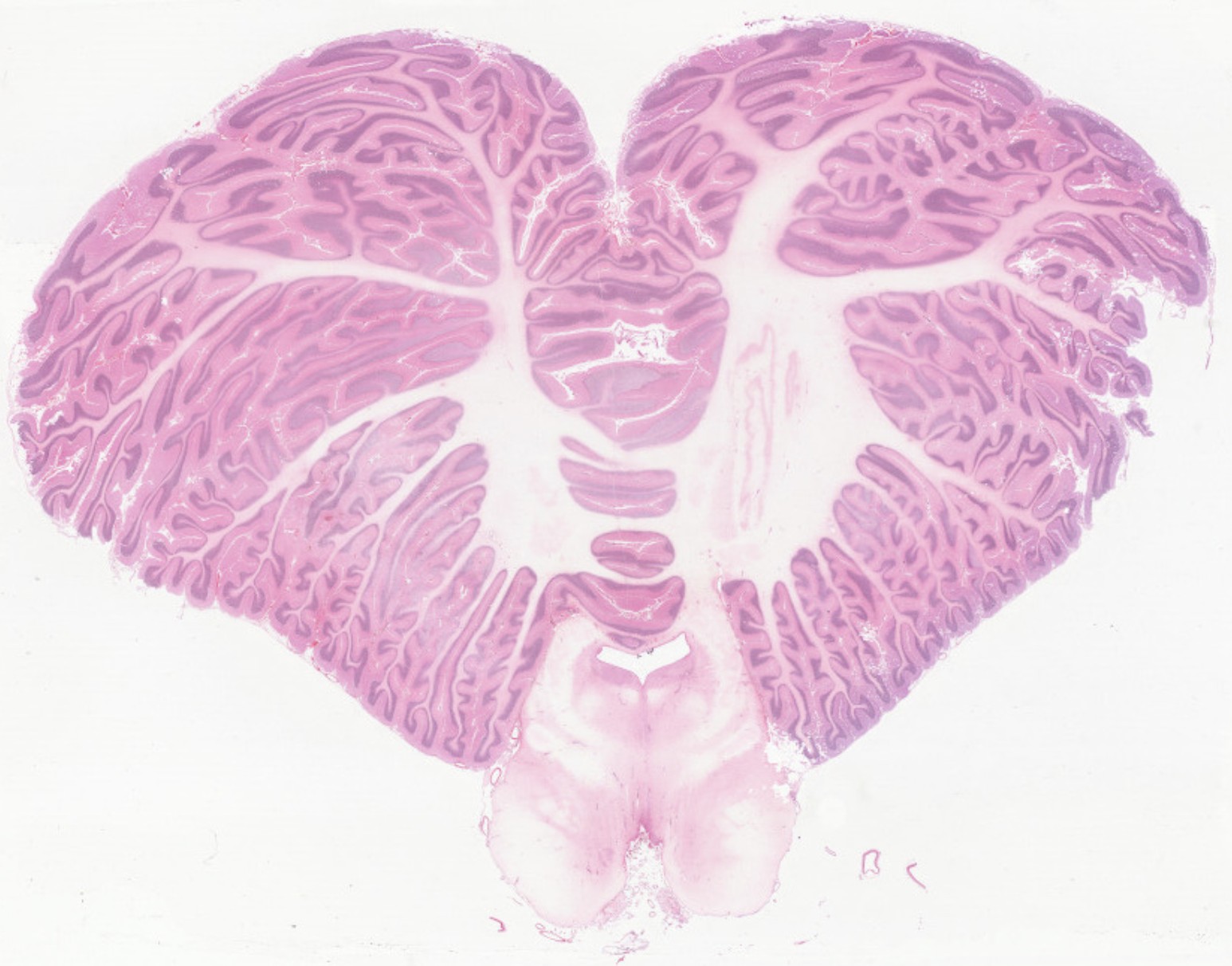 Adult Human Brain Cerebellum H&E stain